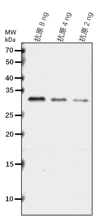 Anti-Receptor-like serine/threonine-protein kinase