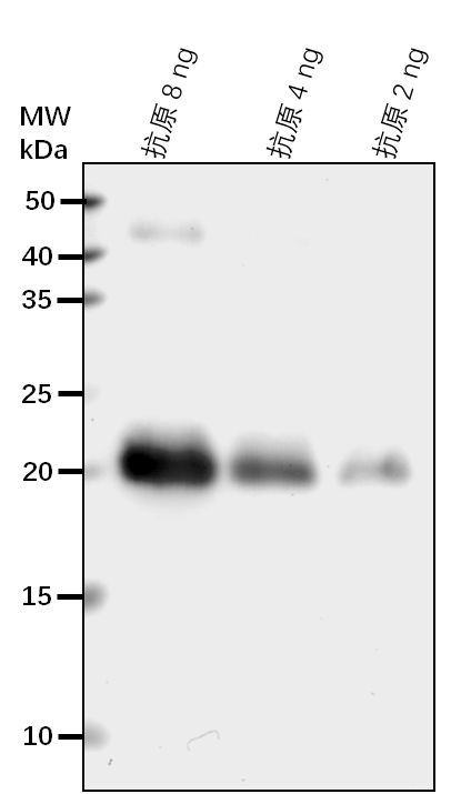 Anti-CCaMK/ Ca2+/calmodulin (CaM)-dependent protein kinase