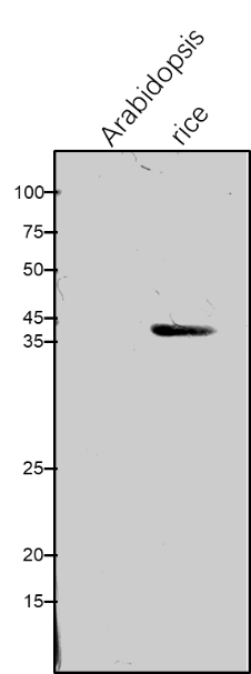 Anti-FBA / Fructose-bisphospate aldolase isozyme antibody