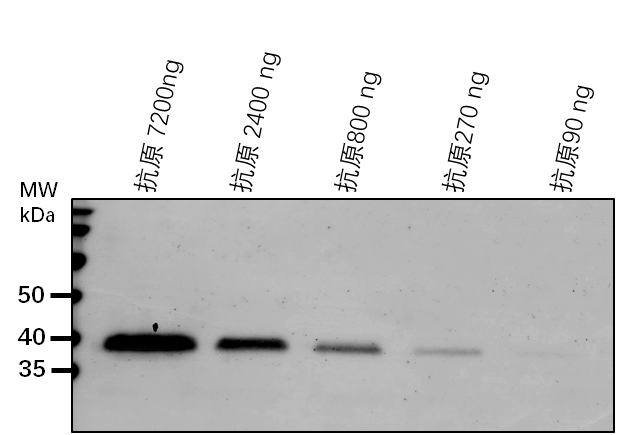 Anti-CCaP1/ Cytosolic calcium-binding protein 1