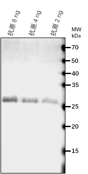 Anti-DEK3/DEK domain-containing chromatin-associated protein