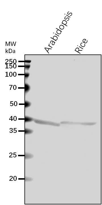 Anti-AGT1/ Serine--glyoxylate aminotransferase