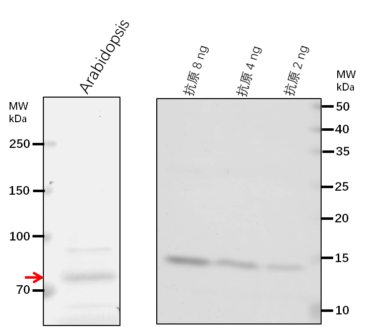 Anti-LACS1/ Long chain acyl-CoA synthetase 1