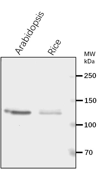Anti-UBA1/ Ubiquitin-activating enzyme E1 1