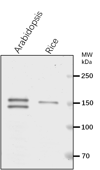 Anti-TPP2/ Tripeptidyl-peptidase 2