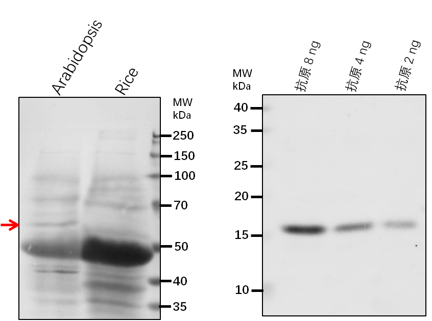 Anti-ETFQO/ ETF-ubiquinone oxidoreductase, mitochondrial