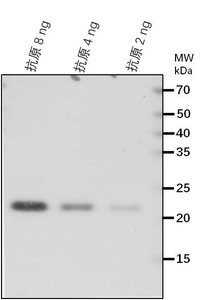 Anti-MGT10/ Magnesium transporter MRS2-11, chloroplastic