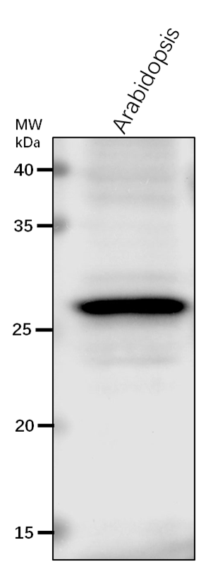 Anti-CLPR3/ ATP-dependent Clp protease proteolytic subunit-r