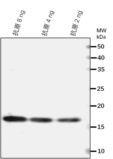 Anti-LYP2/ LysM domain-containing GPI-anchored protein 1