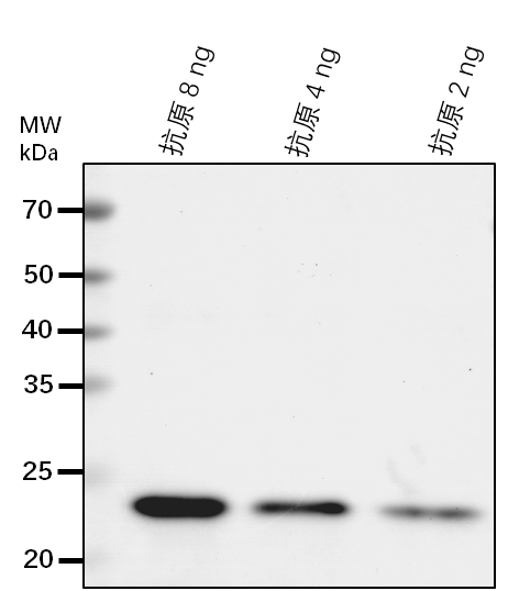 Anti-CSI1/ Protein CELLULOSE SYNTHASE INTERACTIVE 1