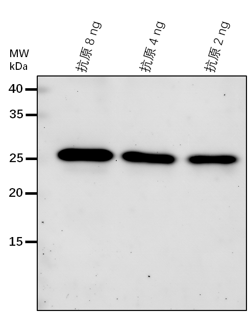 Anti-GLCNAC1PUT2/ UDP-N-acetylglucosamine diphosphorylase 2