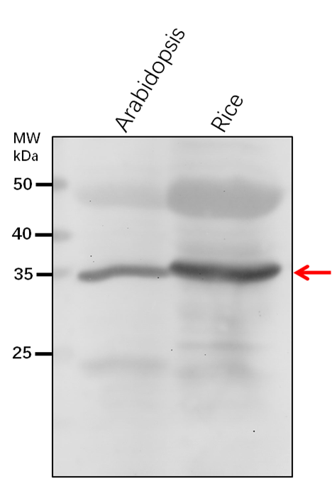 Anti-AGB1/ Guanine nucleotide-binding protein subunit beta