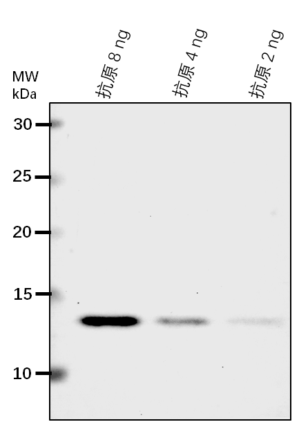 Anti-ADO1/ Adagio protein 1