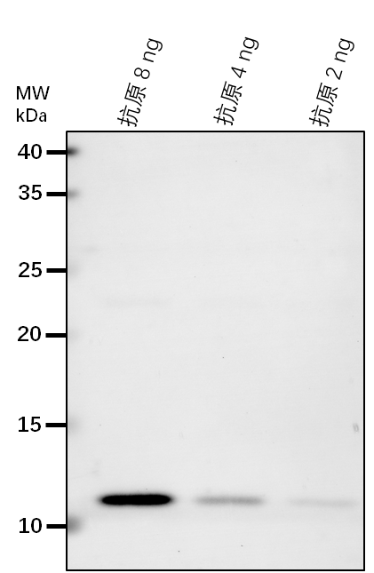 Anti-AGD2/LL-diaminopimelate aminotransferase, chloroplastic