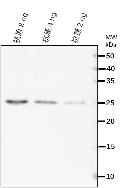 Anti-NAD7/ NADH dehydrogenase subunit 7
