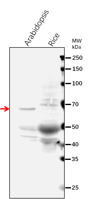 Anti-ASN2/ Asparagine synthetase [glutamine-hydrolyzing] 2