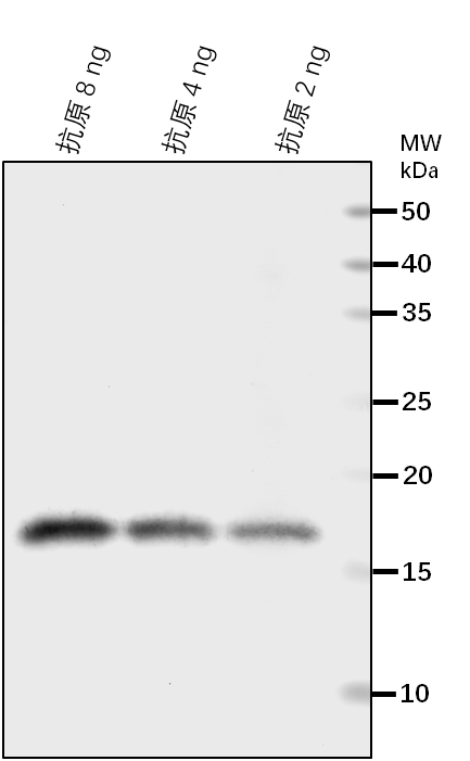 Anti-AKINB1/SNF1-related protein kinase regulatory subunit b