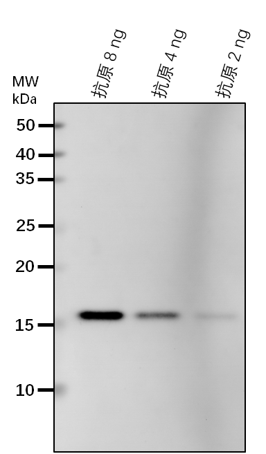 Anti-ACH2/ Acyl-CoA hydrolase 2