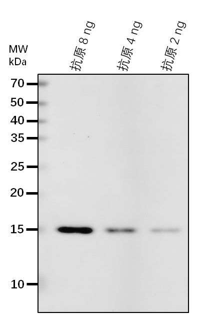 Anti-ECHID/ Enoyl-CoA hydratase/isomerase D