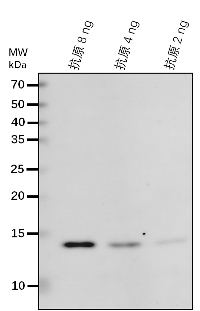 Anti-SNF4/ Sucrose nonfermenting 4-like protein