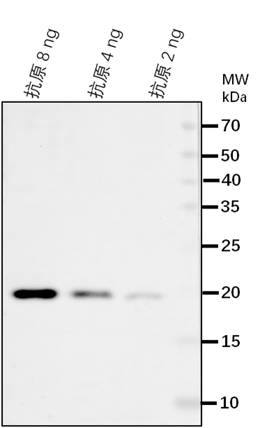Anti-ELP2/ Elongator complex protein 2