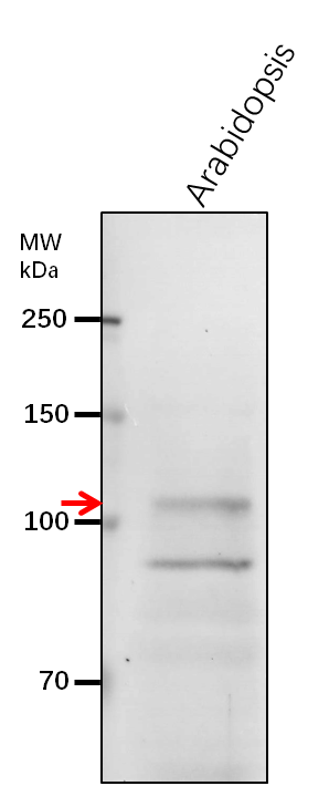 Anti- HGL1/ Heteroglycan glucosidase 1