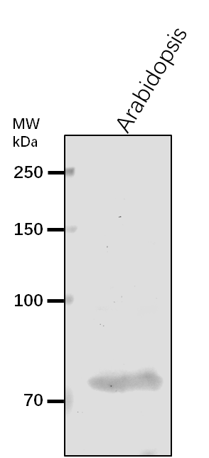 Anti-CRS1/ Chloroplastic RNA splicing factor 1