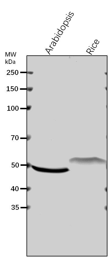 Anti-UGP2/ UTP--glucose-1-phosphate uridylyltransferase 2