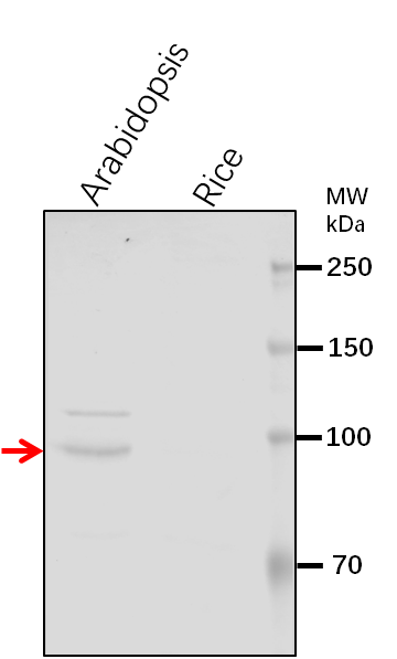 Anti-VPS53/ Vacuolar protein sorting-associated protein 53 A