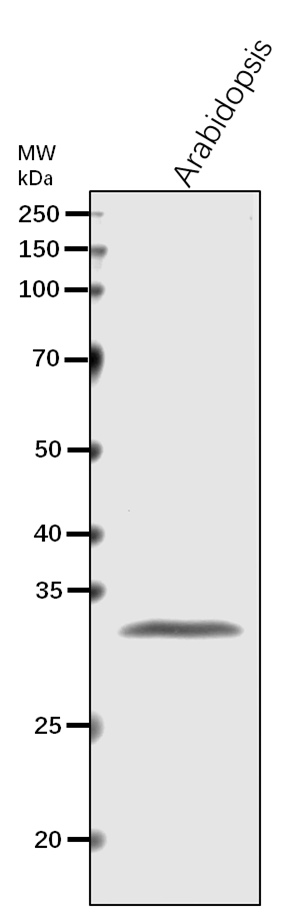 Anti-rps5/ Small ribosomal subunit protein uS5c