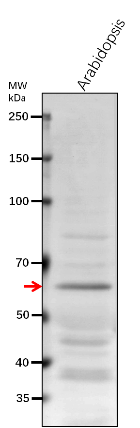 Anti-P5CDH/ P5C dehydrogenase, mitochondrial