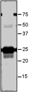 Anti-Lhcb5/ Chlorophyll a-b binding protein CP26 antibody