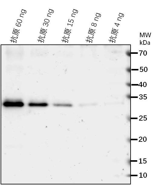 Anti-NAC60/ NAC domain-containing protein 60