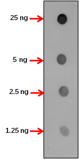 Anti-ACBP1/ Acyl-CoA-binding domain-containing protein 1