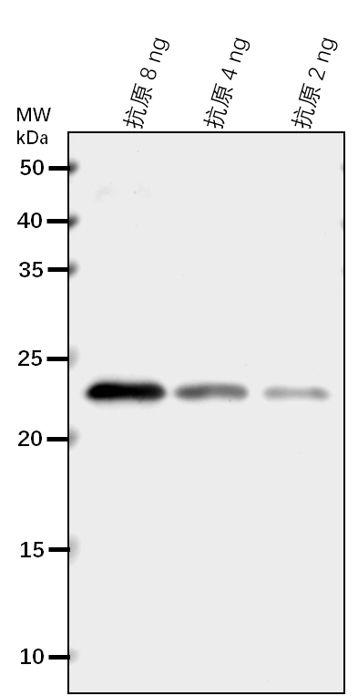 Anti-ACCT2/ Acetyl-CoA acetyltransferase 2