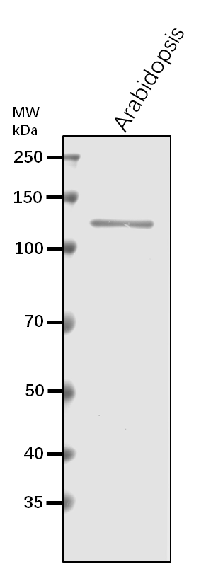 Anti-SPS1/ Sucrose-phosphate synthase 1