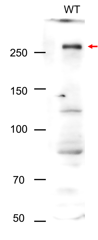 Anti-TOR/ Serine/threonine-protein kinase TOR