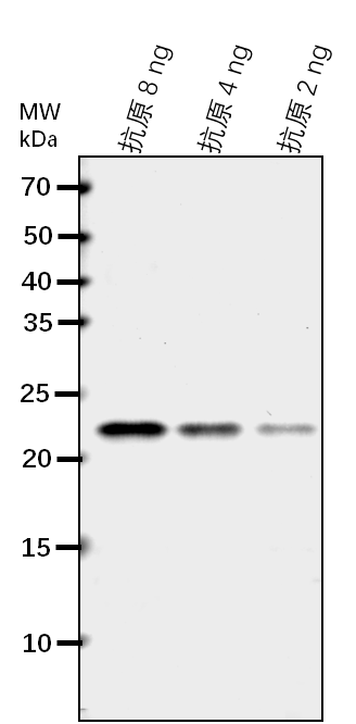 Anti-BCAT3/ Branched-chain-amino-acid aminotransferase