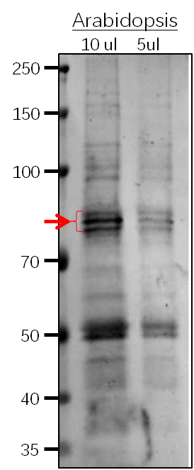 Anti-PAL1/ Phenylalanine ammonia-lyase 1