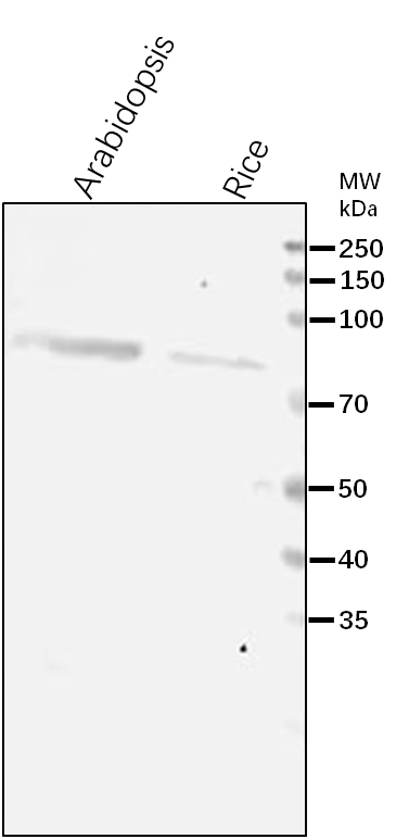 Anti-HDS/ 4-Hydroxy-3-methylbut-2-enyl-diphosphate synthase