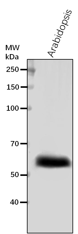 Anti-HEMA2/ GluTR / Glu-tRNA reductase