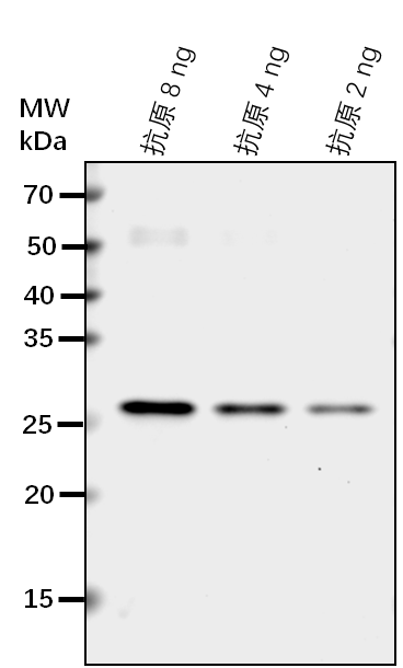 Anti-NPR1/ BTB/POZ domain and ankyrin repeat-containing prot