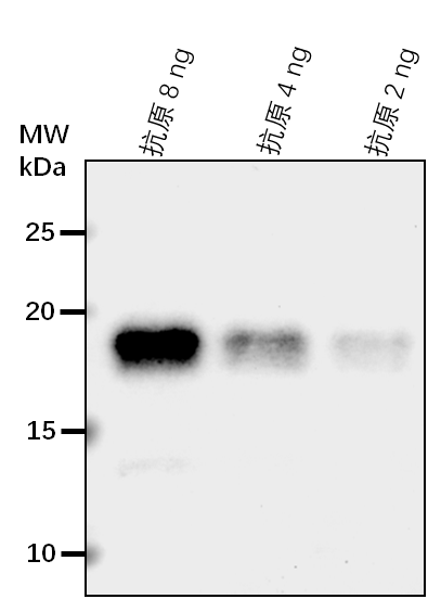 Anti-JMJ14/ Lysine-specific demethylase JMJ14