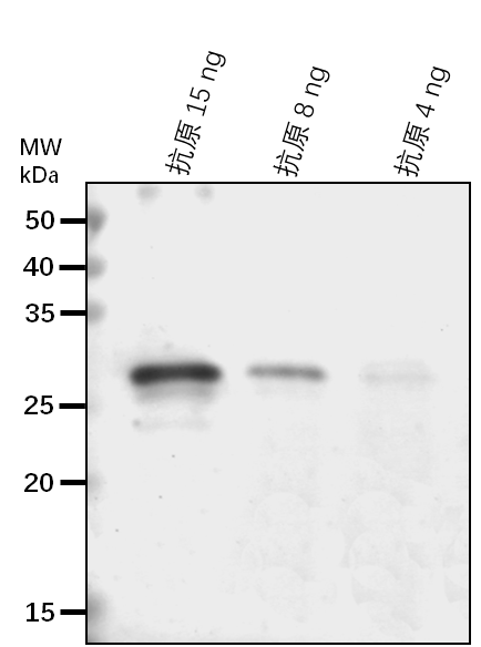Anti-RPS2/ Chloroplast ribosomal complex small subunit S2