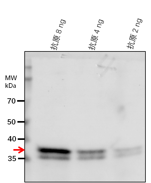 Anti-HDC1/ Uncharacterized protein At5g08450
