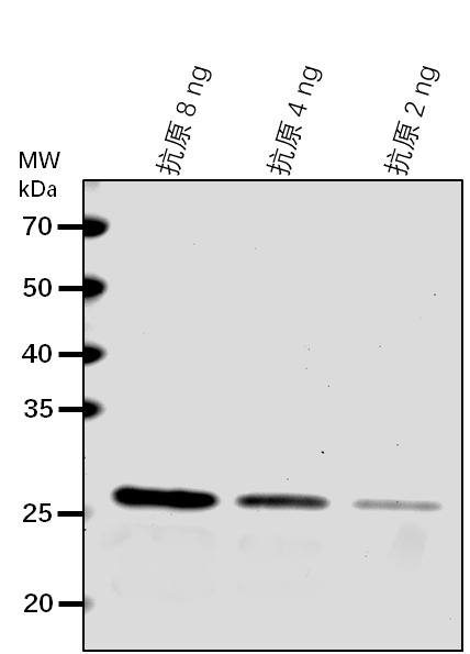 Anti-IPP2/ Isopentenyl-diphosphate Delta-isomerase II