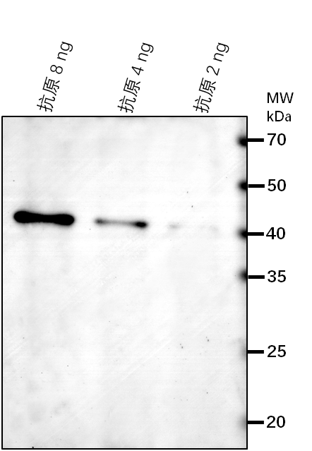 Anti-FRK1/ FLG22-induced receptor-like kinase 1