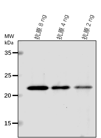 Anti-ECT4/ YTH domain-containing protein ECT4