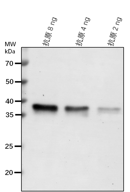 Anti-CTR1/ Serine/threonine-protein kinase CTR1
