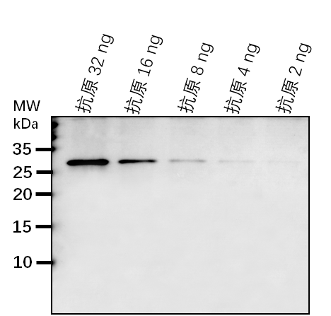 Anti-PRP31/ U4/U6 small nuclear ribonucleoprotein Prp31